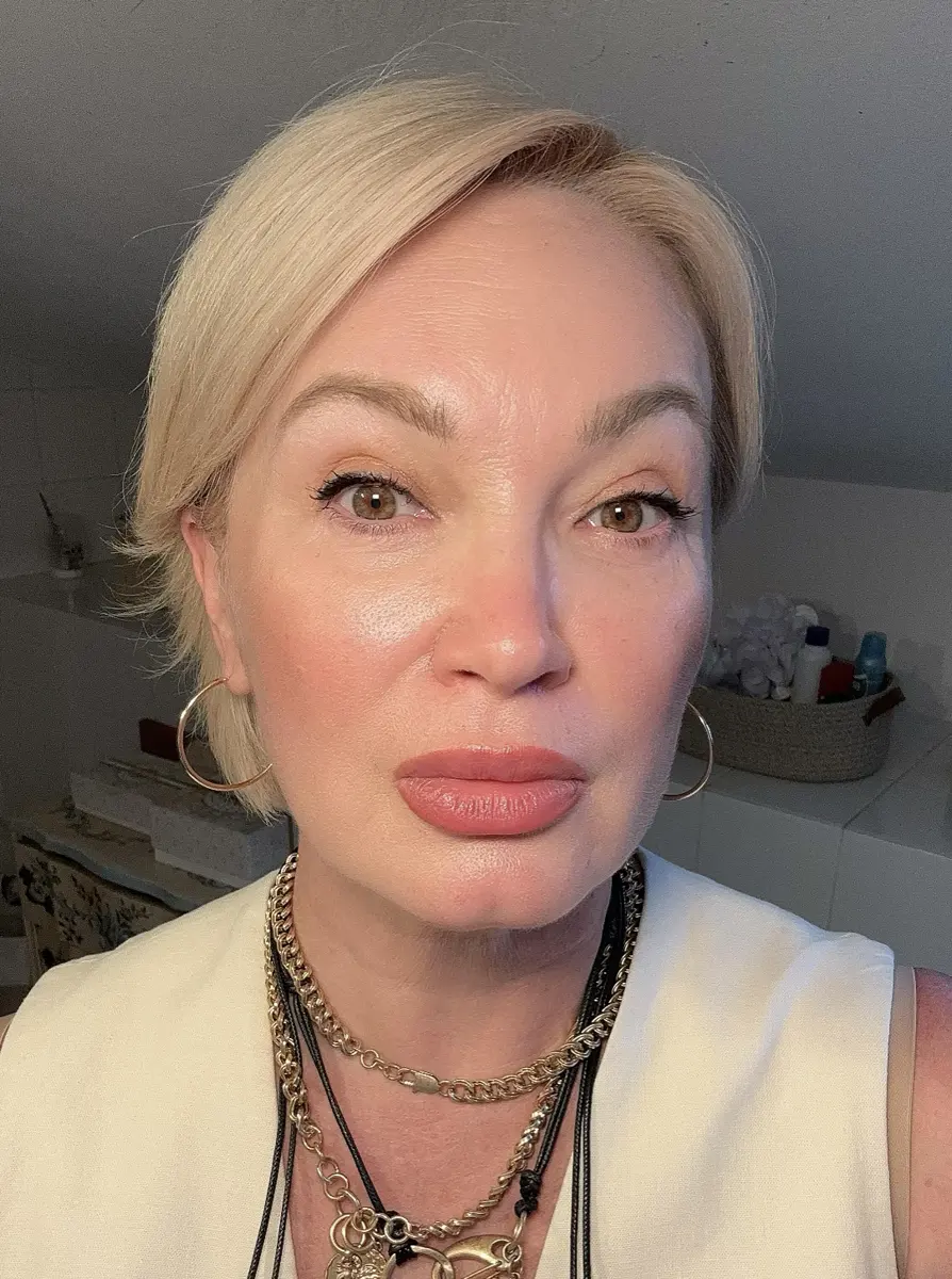 Before and after skin transformation results