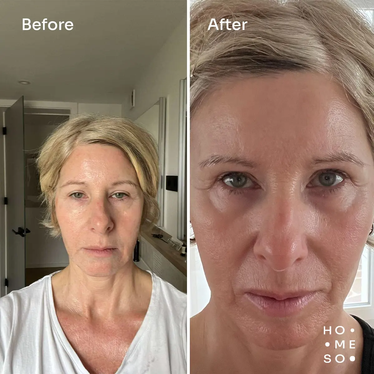 Кому подойдет HoMEso?